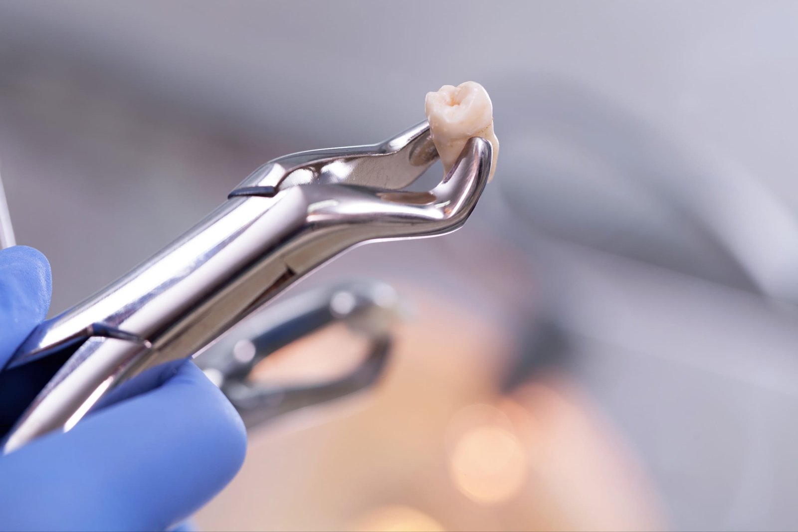 Tooth-Extraction_181664247
